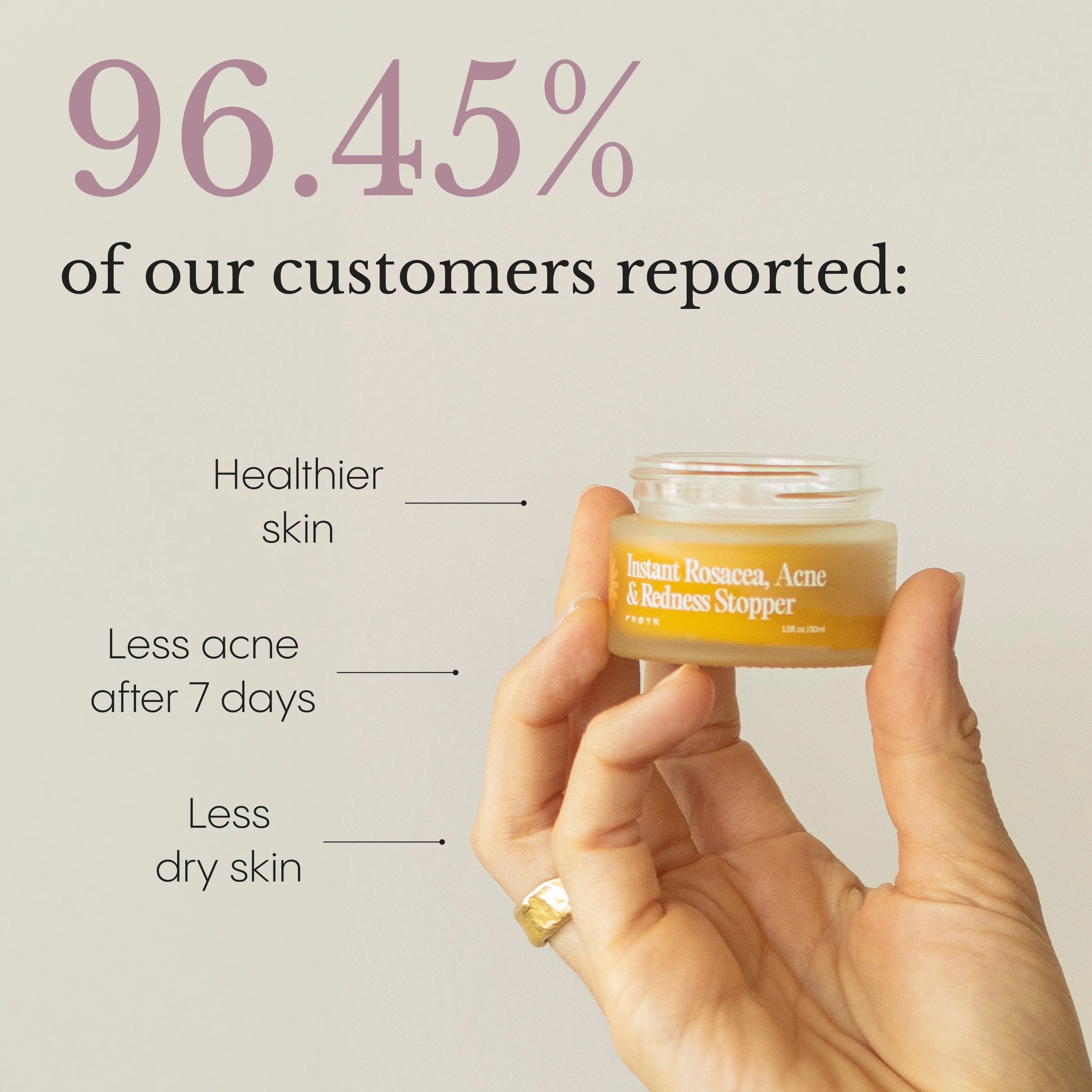 The Complete Acne System for Women - Image 7