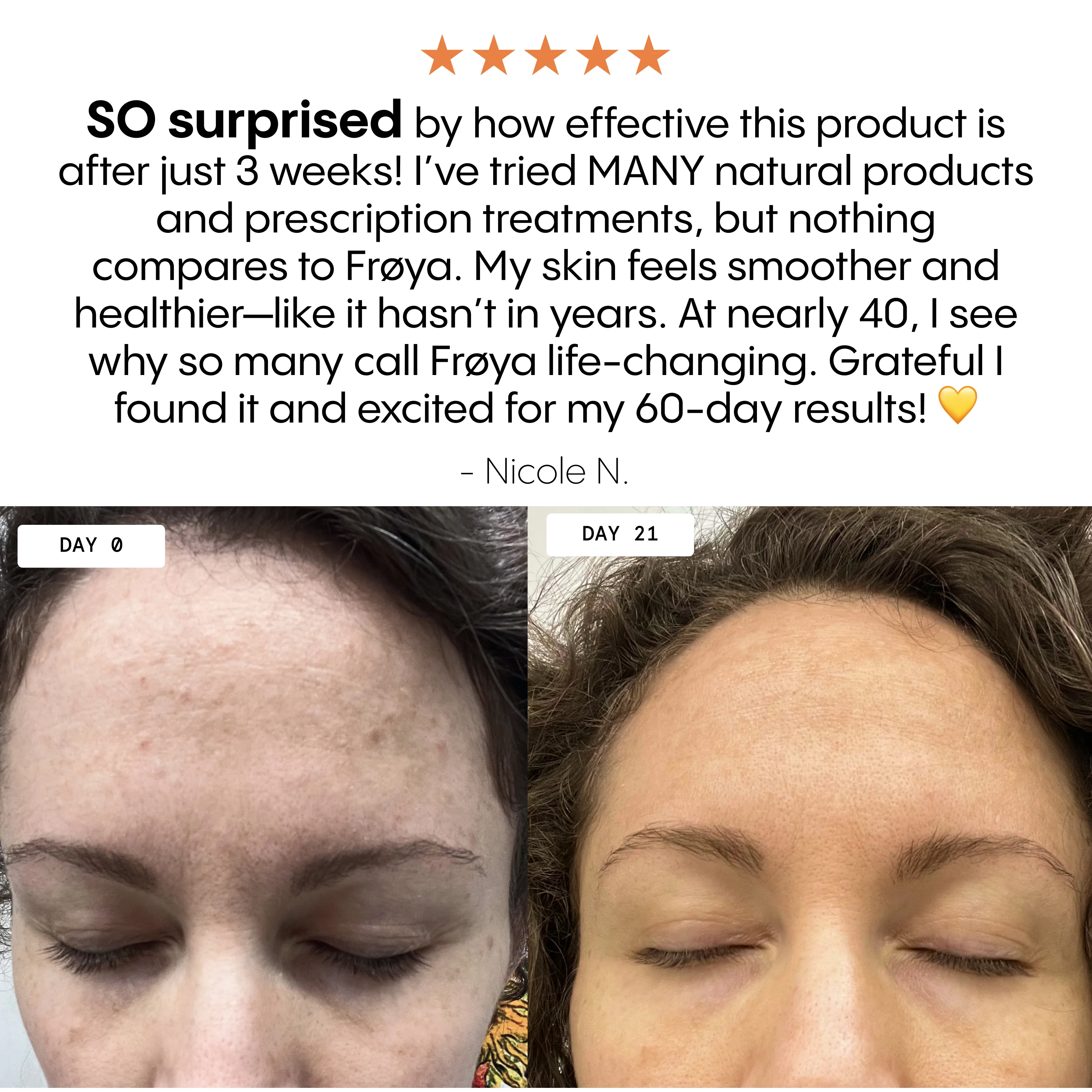 The Complete System for Mature Women’s Skin - Image 7