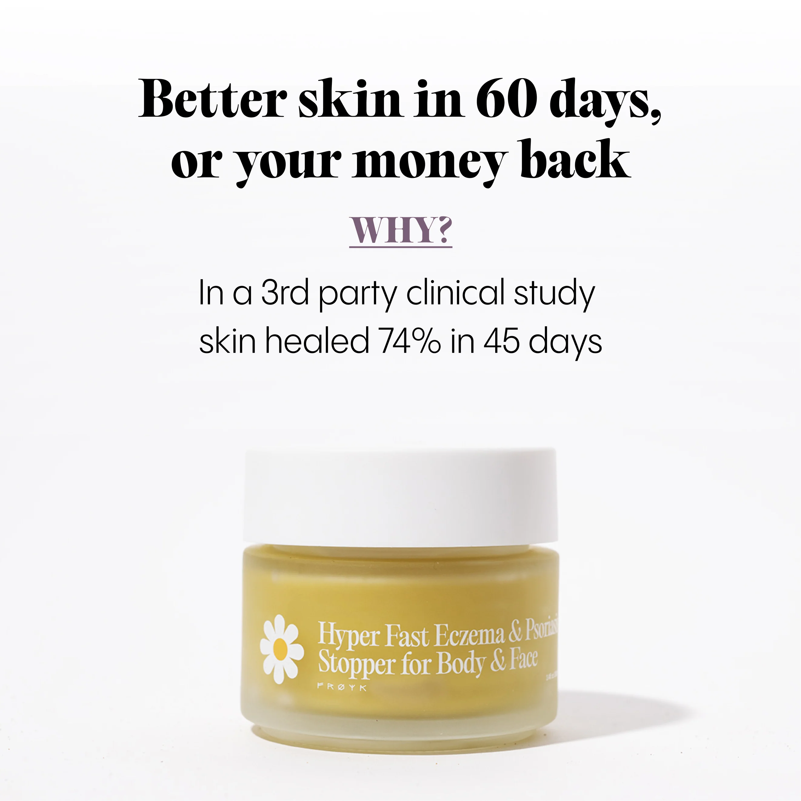 Ultra-Fast Relief Balm for Dry, Itchy Skin – For Body & Face - Image 9